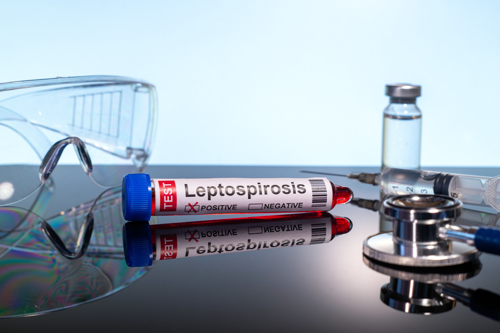 Blood,Collection,Tubes,Leptospirosis,Test,Positive,Results.leptospirosis,,Also,Called,Weil's