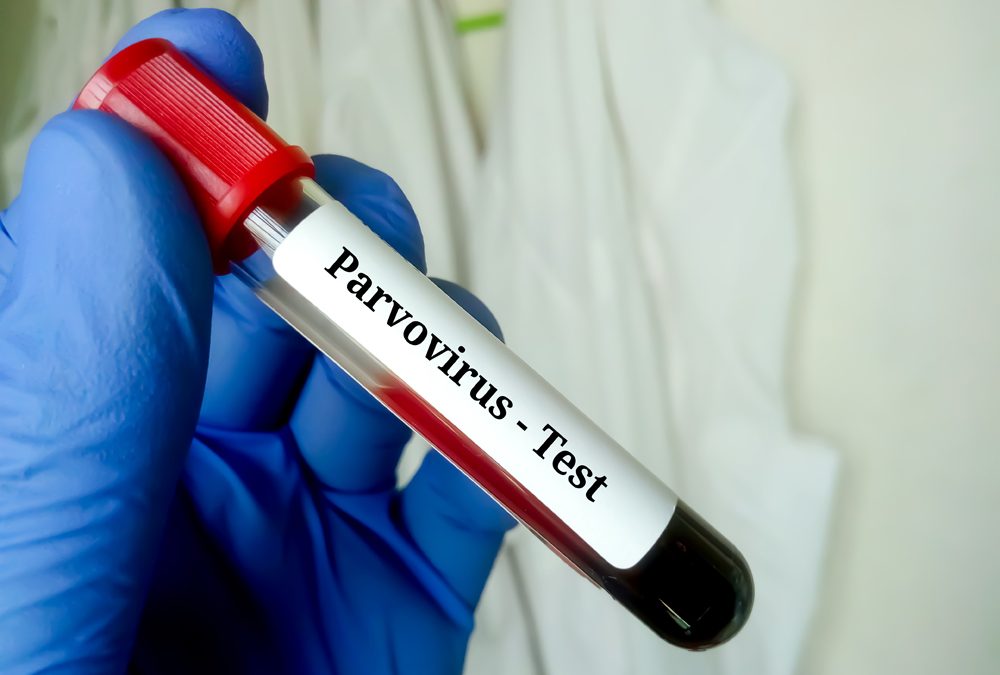 Blood,Sample,For,Parvovirus,Test