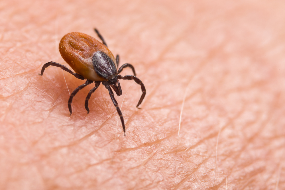 Infected,Female,Deer,Tick,On,Hairy,Human,Skin.,Ixodes,Ricinus.