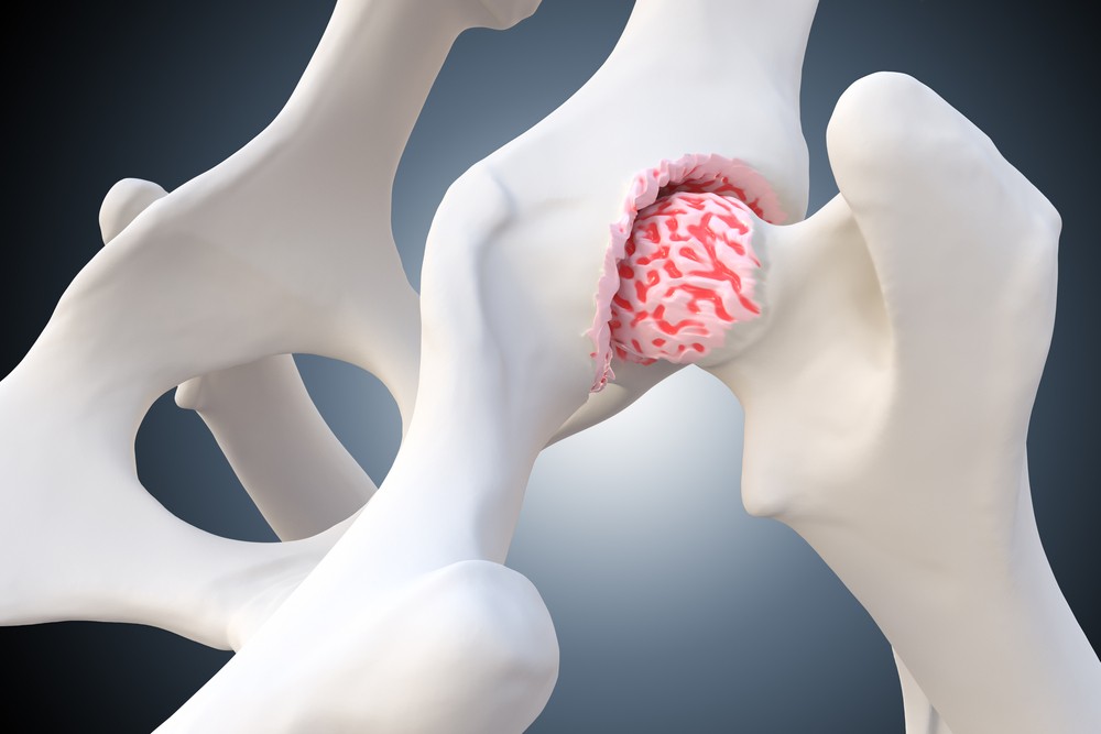 Positive Results from Osteoarthritis Clinical Study in Dogs Reported by Can-Fite’s Partner Vetbiolix