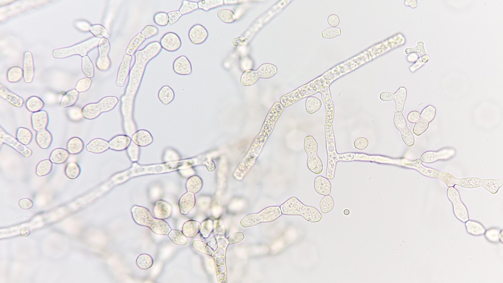 Neospora Isn’t Gone. So Why Aren’t We Talking About It?