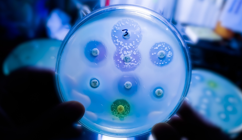 Antimicrobial,Susceptibility,Testing,In,Petri,Dish.,Microbiologist,Check,Antibiotic,Resistance