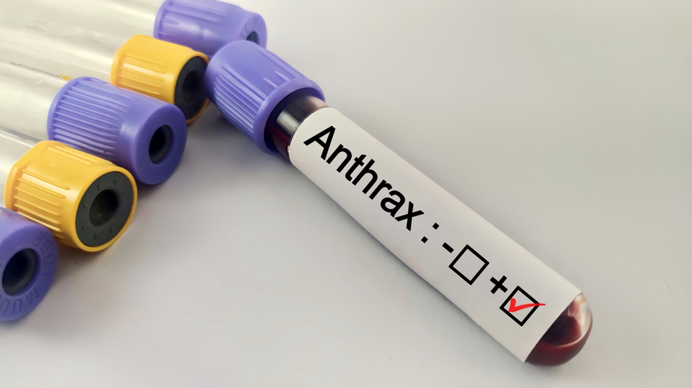 Third US Case of Anthrax Discovered in Texas Goat