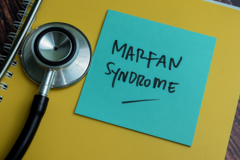 First Known Cases of Feline Marfan Syndrome Discovered in Cat Siblings