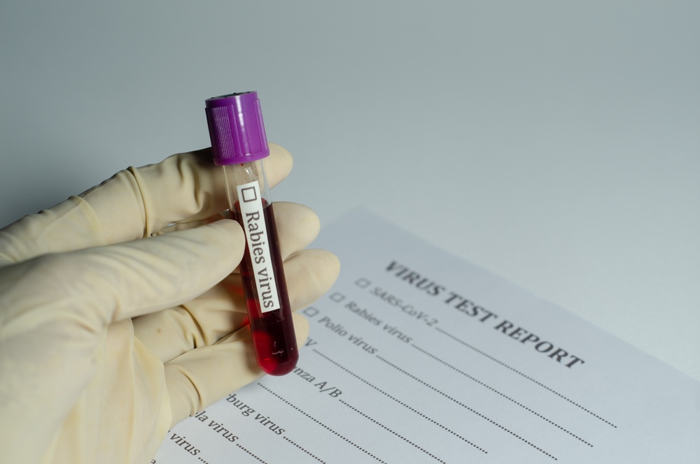 Rabies Testing Concerns Prompt Investigation from Minnesota Health Officials
